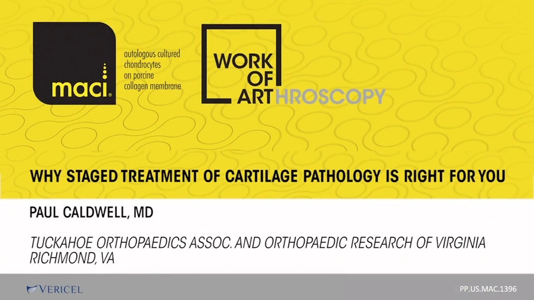 Art of Arthroscopy: Why Staged Treatment of Cartilage is Right for Your Patient?