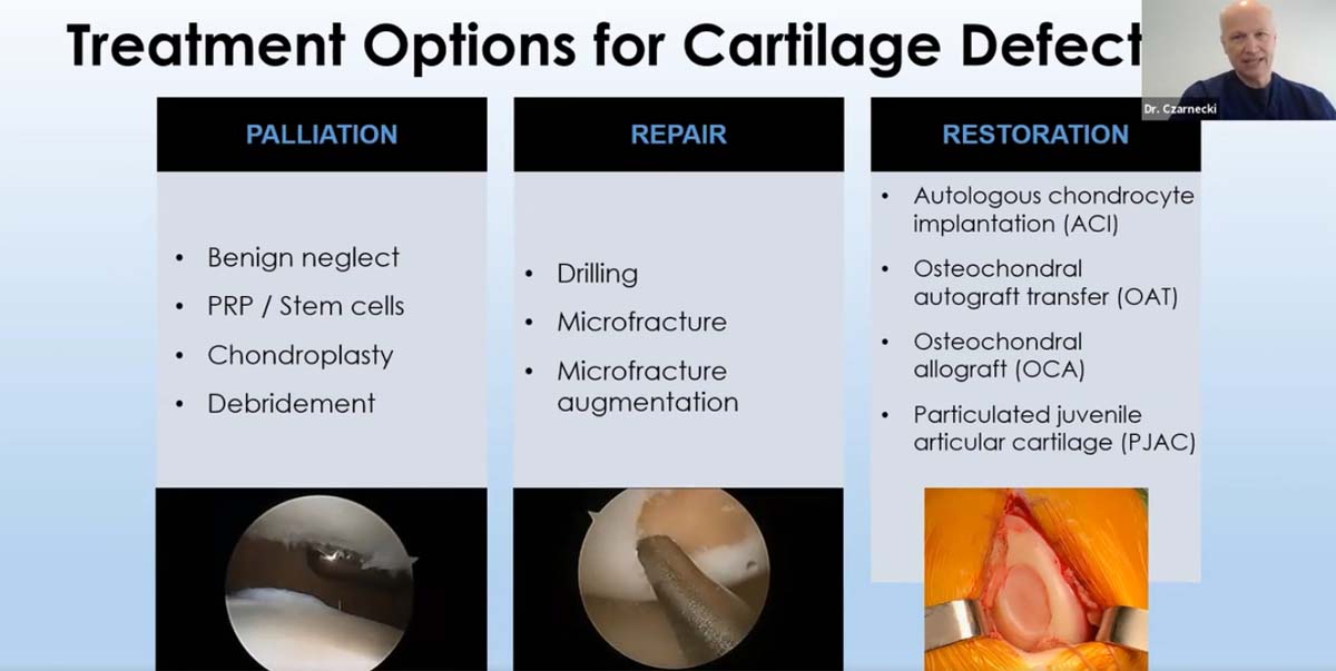 Explore MACI Clinical inars for the Latest Innovations in Knee Cartilage Repair