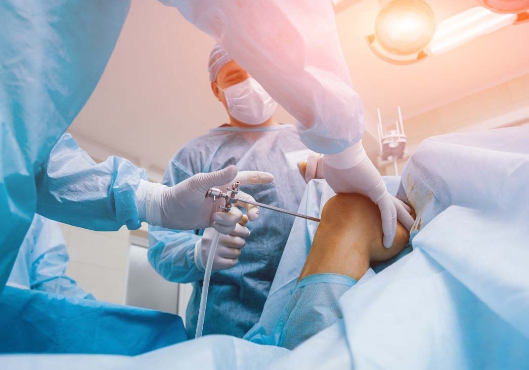 Patient undergoing a chondroplasty for knee cartilage damage
